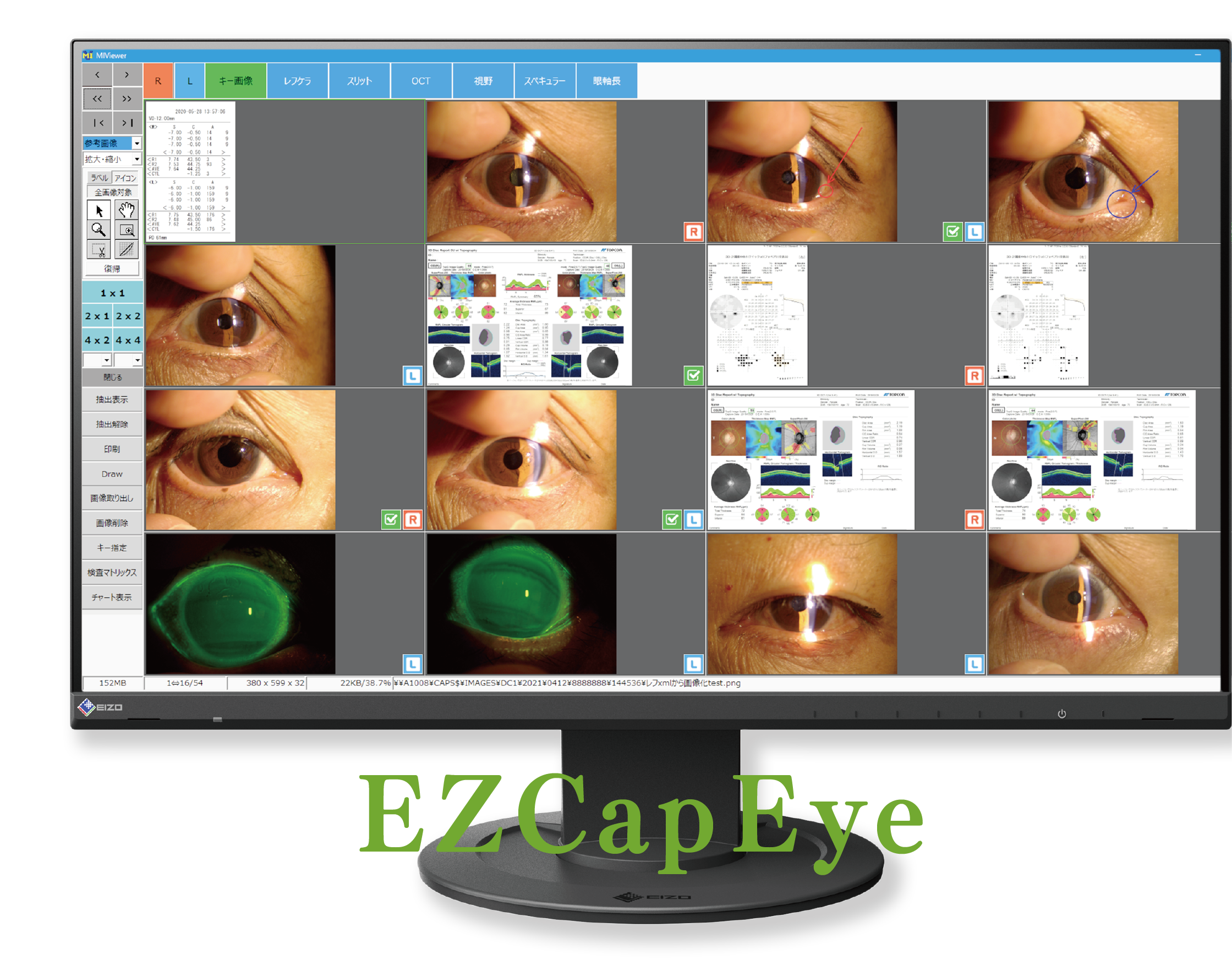 3Z社 画像ファイリング 「EZCapEye」