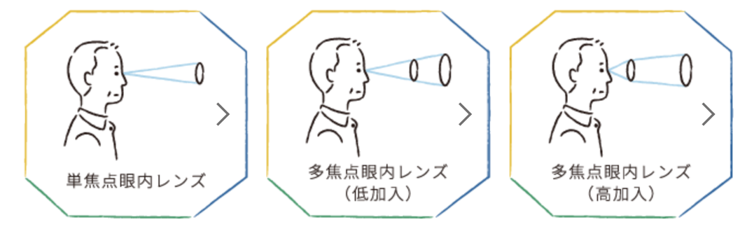 単焦点レンズと多焦点レンズの違い